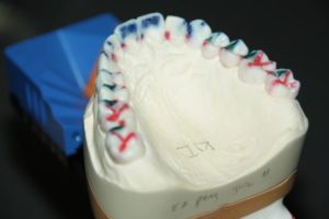 Funktionsdiagnostik