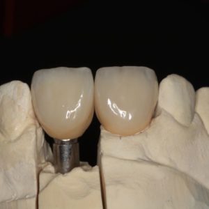 Implantate